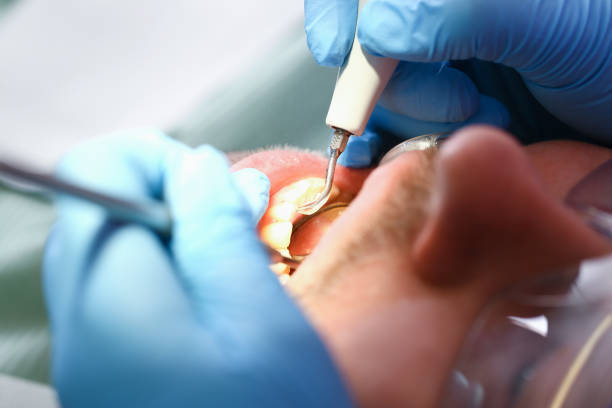 Best Walk-In Emergency Dentist in Ingram, TX